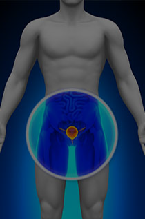 A Biopsia Transperineal da Próstata